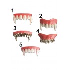 Зъби горни, 5 модела